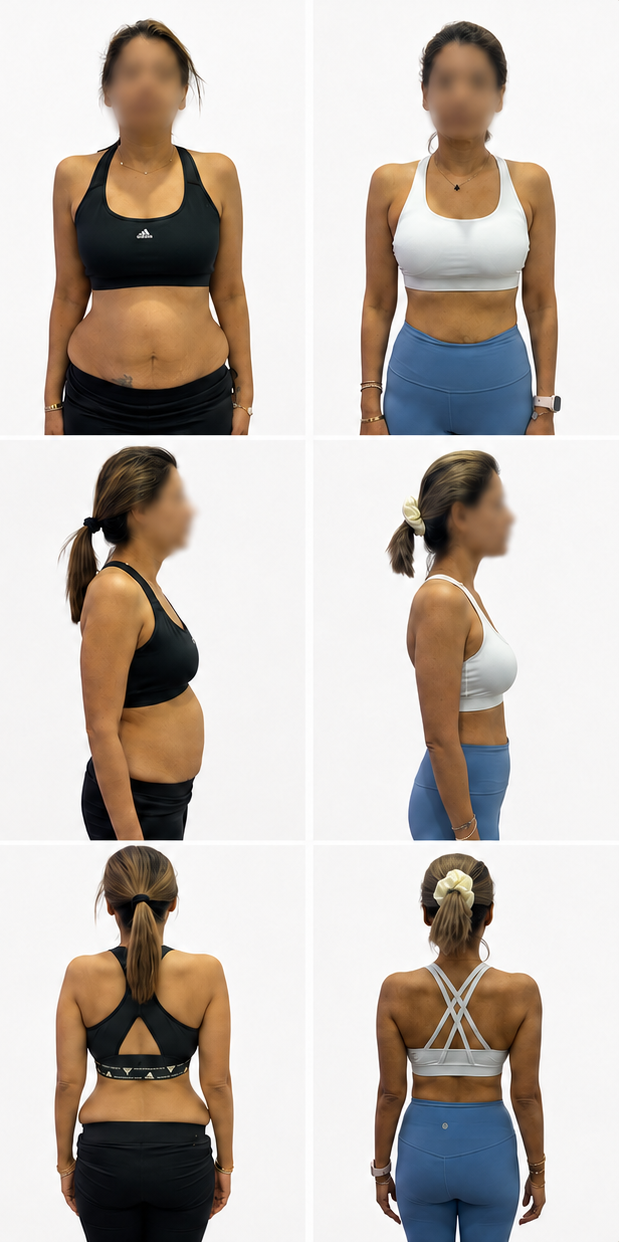 GT Coaching client, 18 weeks: front view, before on the left and after on the right.