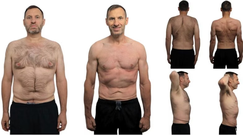Damian White: front view, before on the left and after on the right.