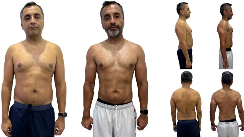 Karan Raney: front view, before on the left and after on the right.
