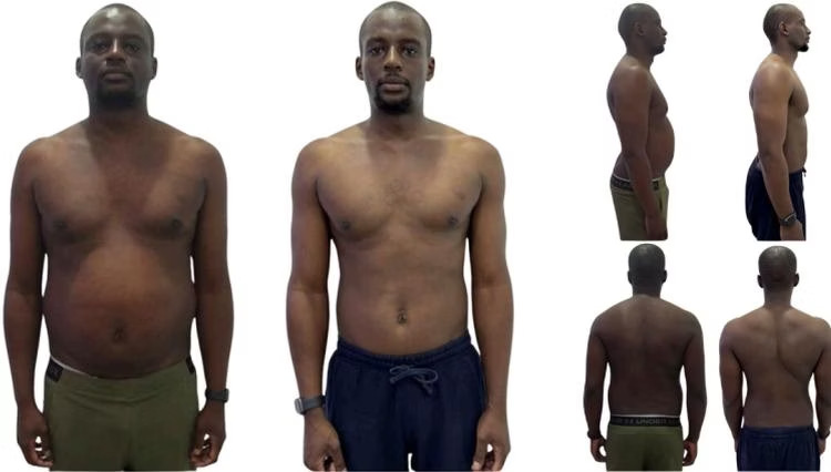 Michael Thinji: front view, before on the left and after on the right.