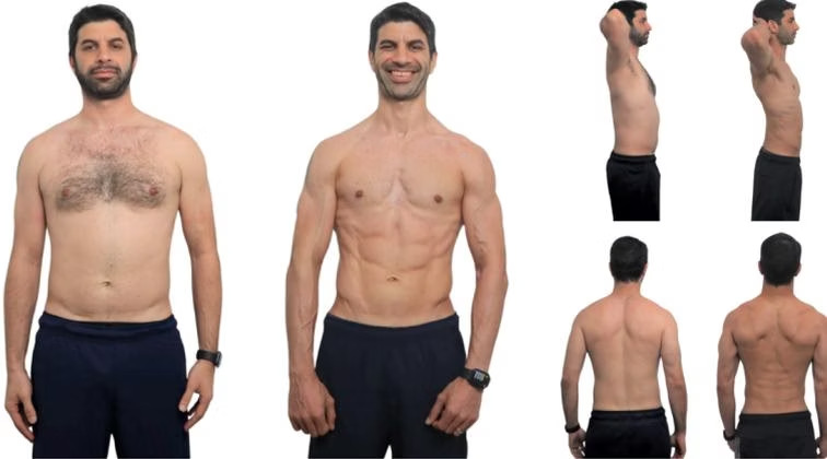 Naser Sultan: front view, before on the left and after on the right.