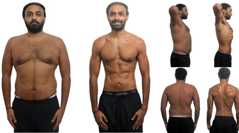 Vimal Patel: front view, before on the left and after on the right.